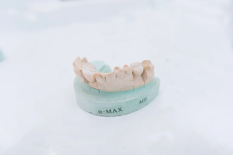 審美歯科